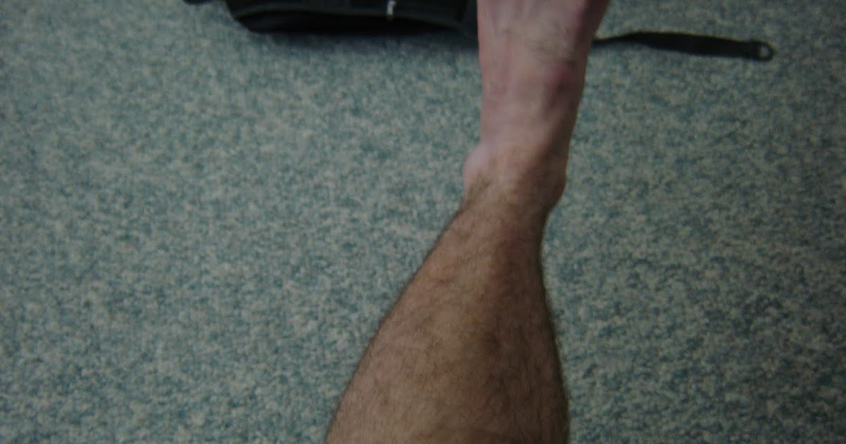 The Quest for Height Grow Taller Increase Height Bone Size The