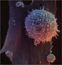 Aid Virus