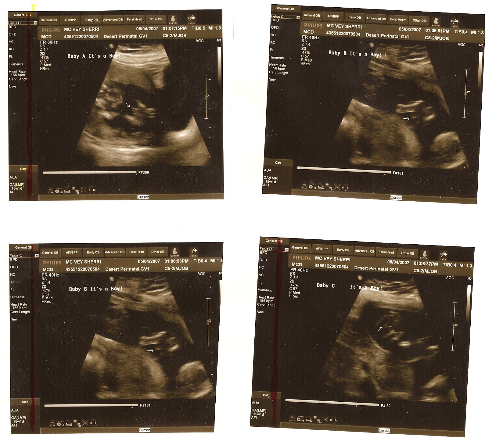 [15+Weeks+I+-+5-04-07.bmp]
