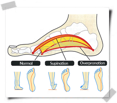 Feet-Types