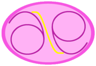 ALE