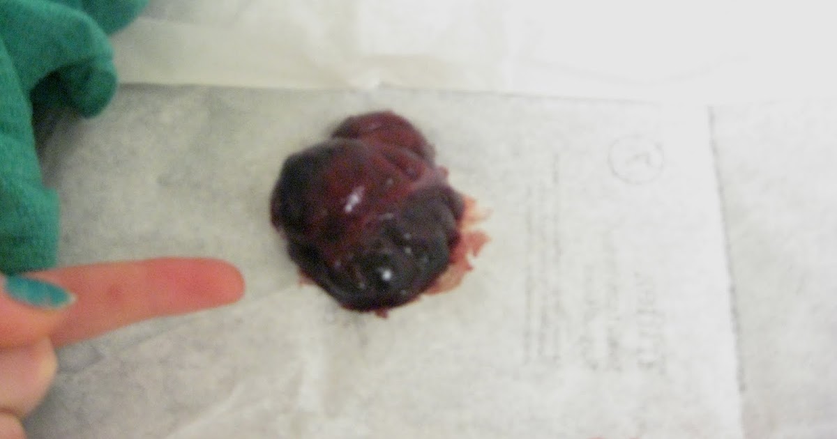 Veterinary Project: Spleen Tumor