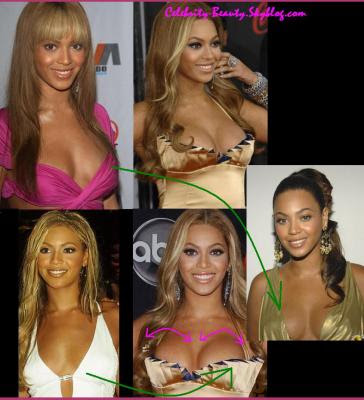 Beyonce Plastic Surgery on Beyonce Plastic Surgery By Andrew