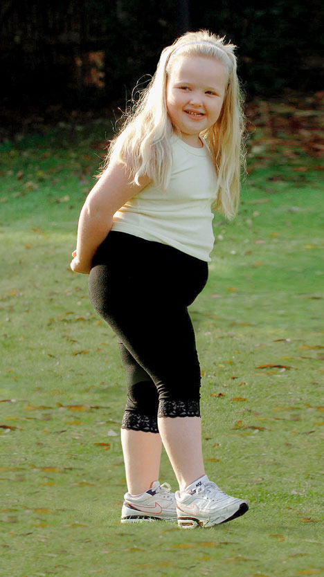Fat Child Girl