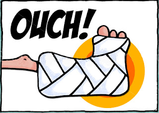 Calcaneofibular Ligament