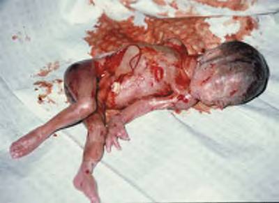 [abortedbaby05.jpg]