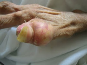 anorexia, anorexic, woman, hand