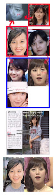 hey hey hey: [ Koo Hye Sun ] Before & After Plastic Surgery
