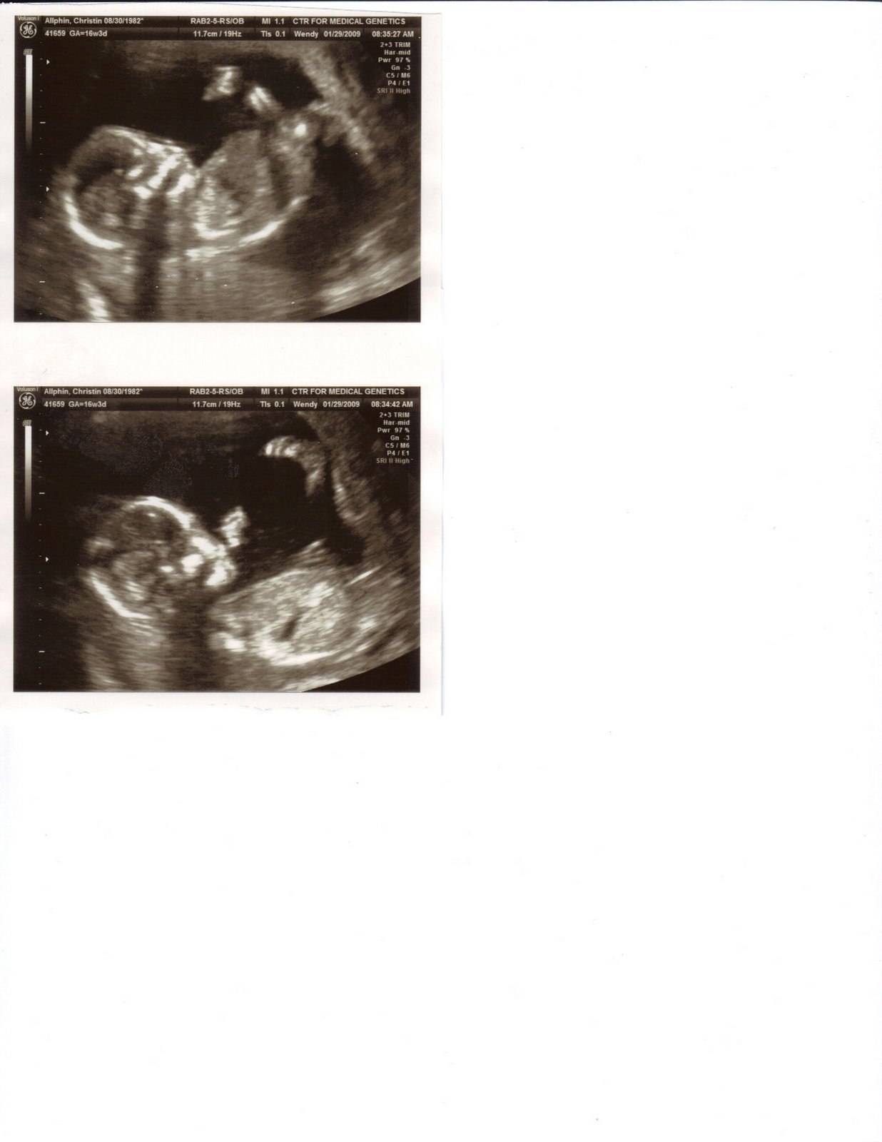 [Baby%20Allphin%2016%20weeks[1].jpg]