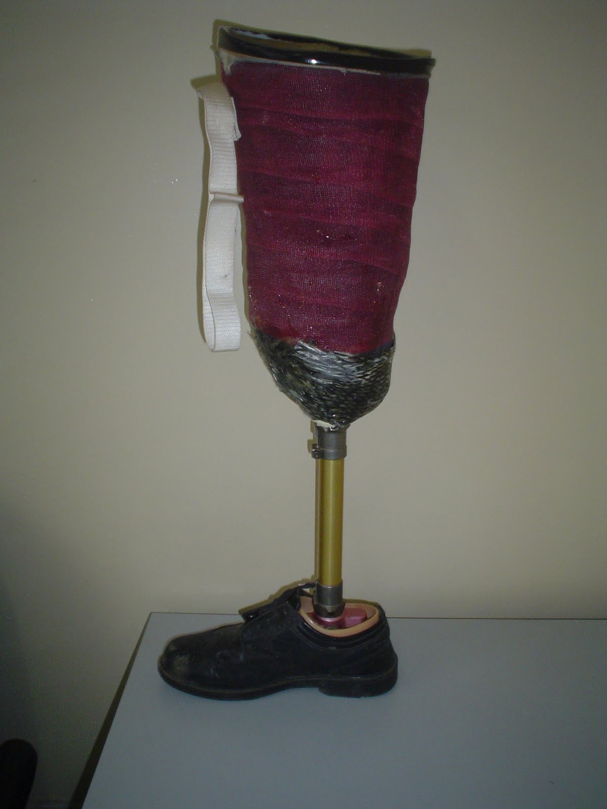 Removable rigid dressing amputation picture