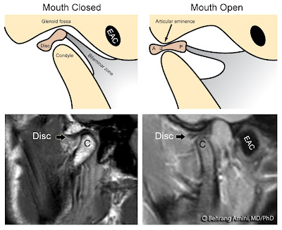 Mandibular+condyle+anatomy