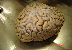 cerebro