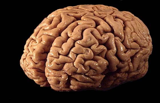 [brain4.jpg]
