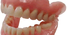 Denture Vs Implant