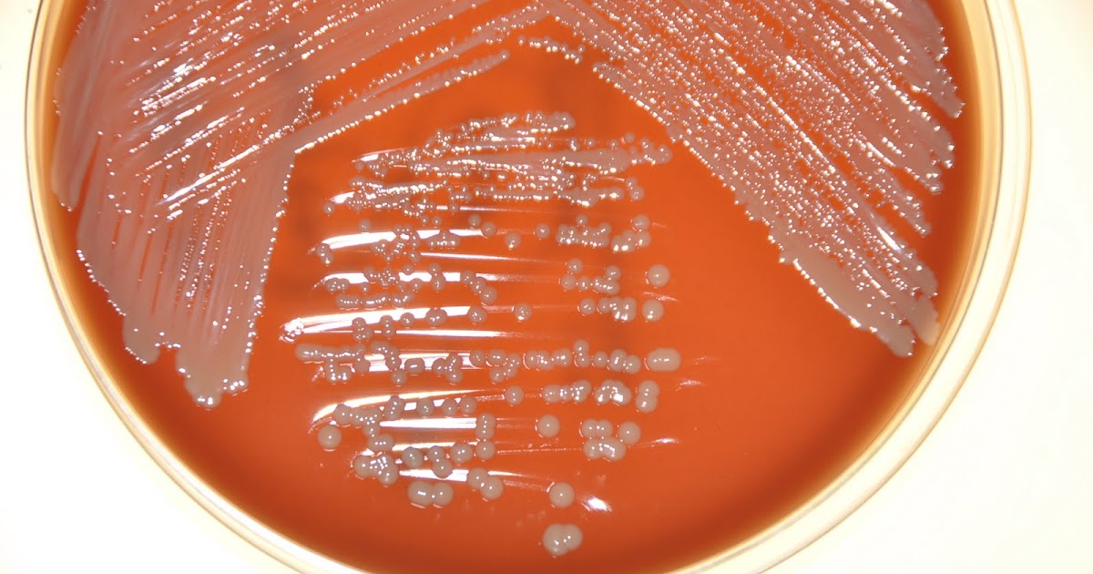 FOTOGRAFIAS DE JDOURADO Staphylococcus haemolyticus