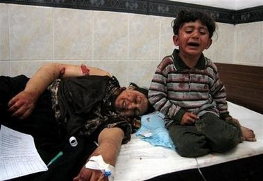 El 11 de Septiembre no se compara a: Iraq+wounded+motherchild+mar+10+2007+aa