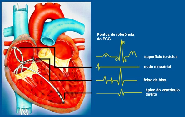 INSUFICIENCIA AND CARDIACA insuficiencia and cardiaca: