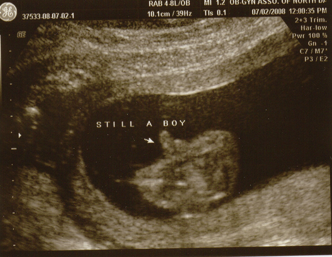 [babynew1.jpg]