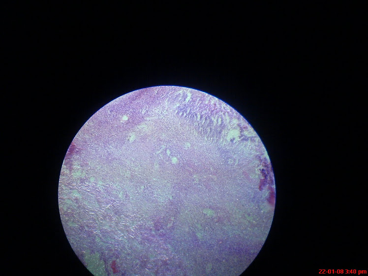 Histopathological slides