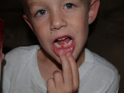 First Lost Tooth