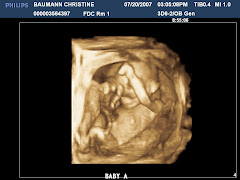 Baby A - 18 weeks