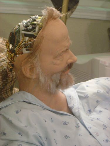 [head-from-side.jpg]