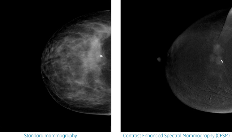 rencontre de la cancérologie française 2011