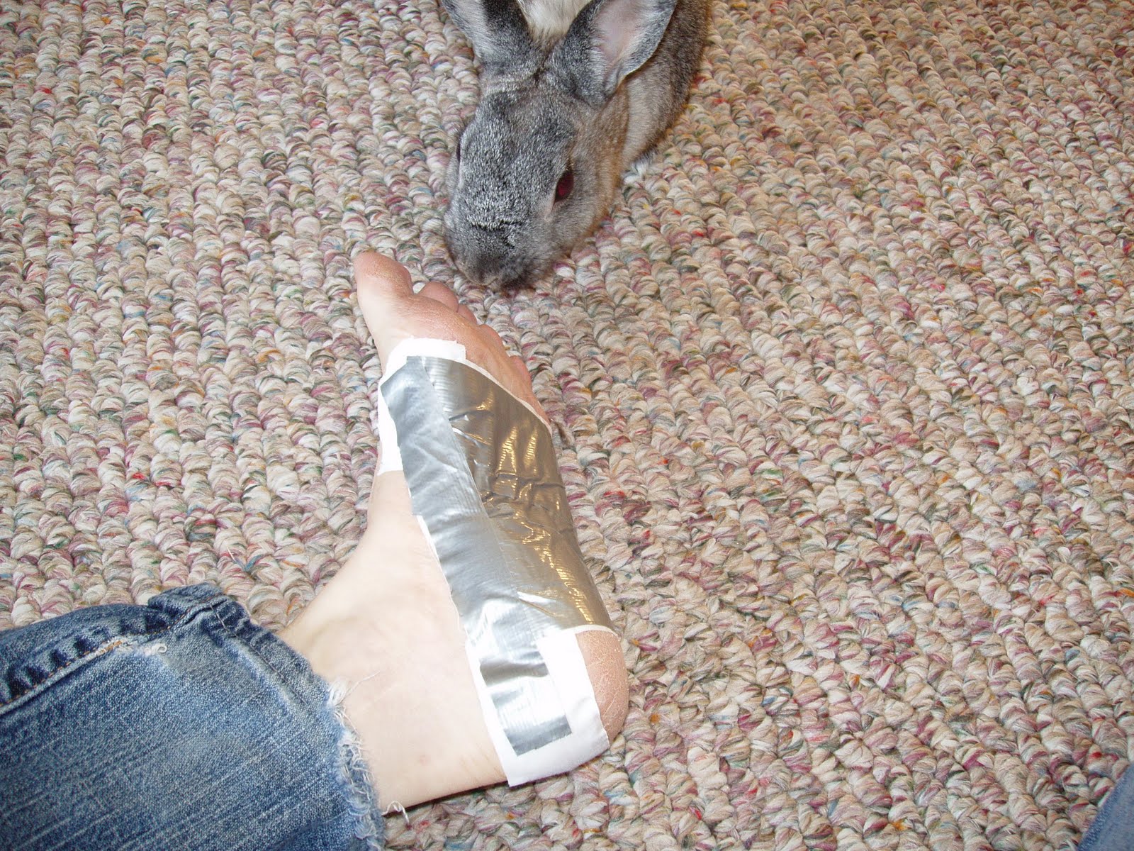Duct Tape Foot Blisters at Ruby Schwarz blog