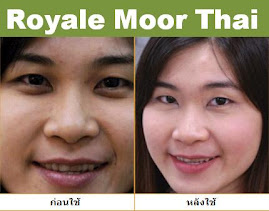 ผู้ใช้ผลิตภัณฑ์ Royale Moor Thai 2