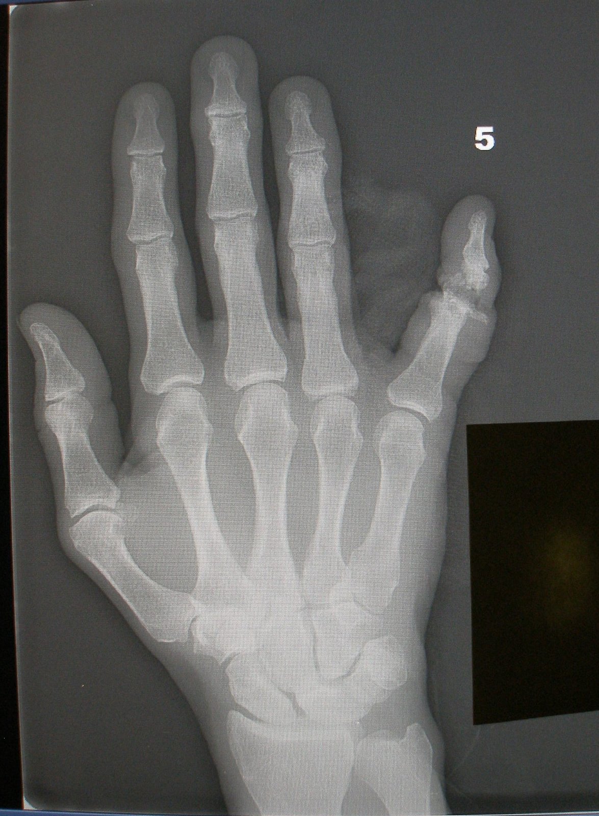 [PA180006.JPG]