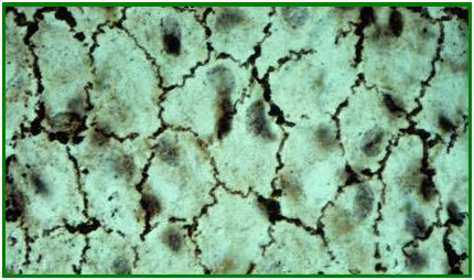 JARINGAN EPITHELLIUM