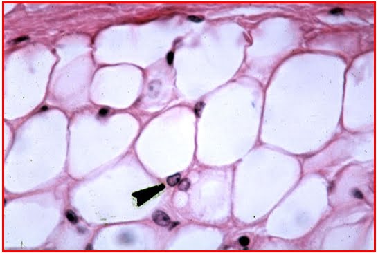 Gambar Jaringan Lemak 1
