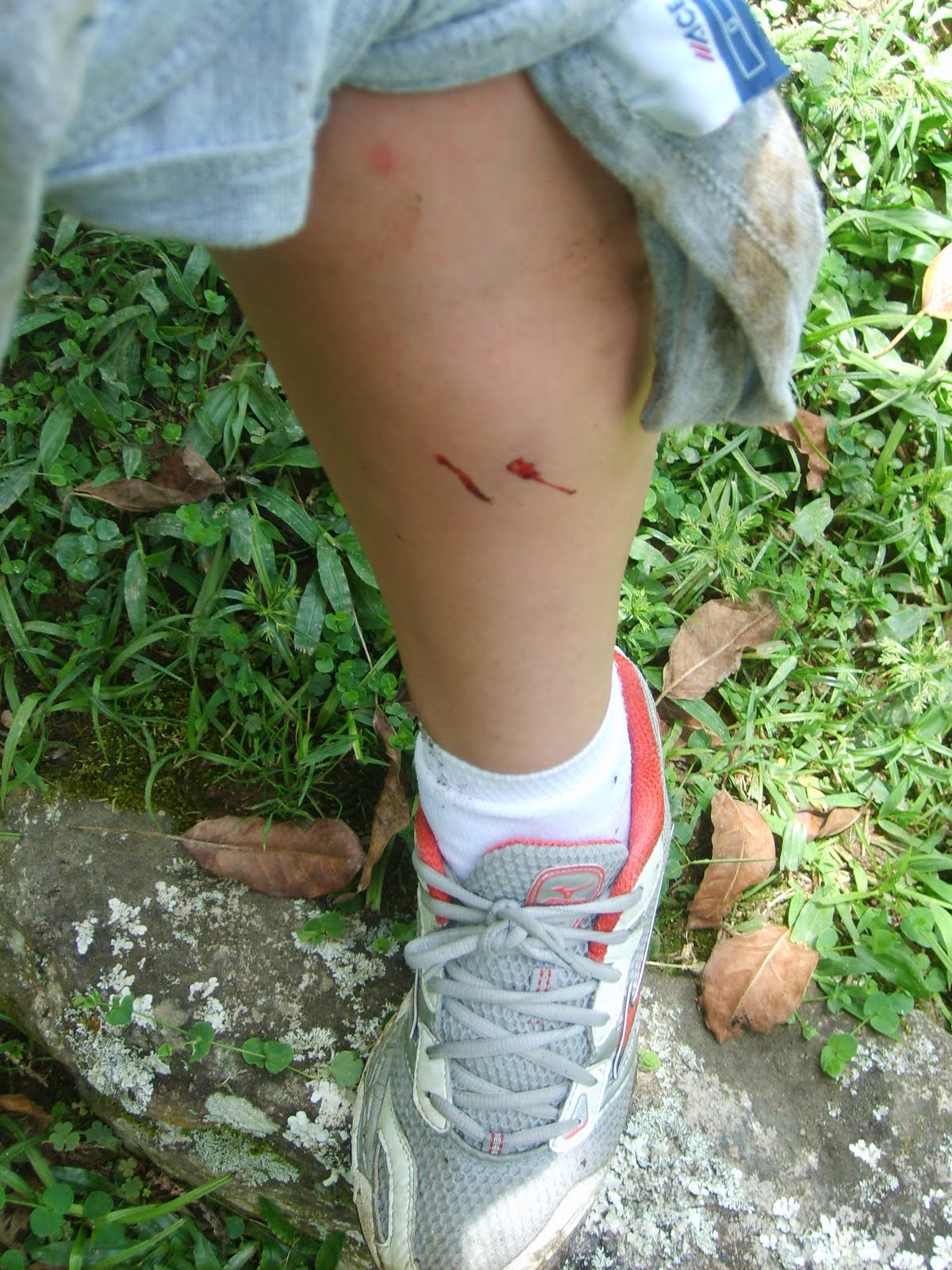 [LogoApósAPicada.JPG]