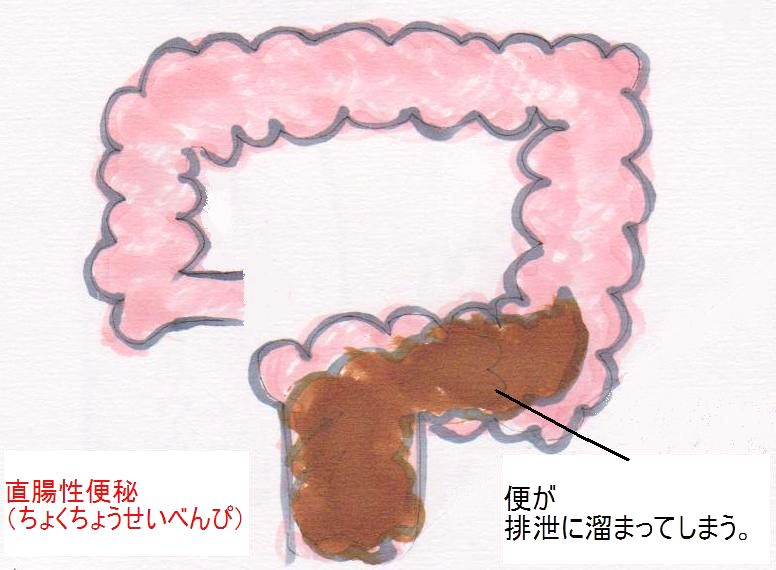 便秘解消への道 2 ためしてガッテン 便秘解消法