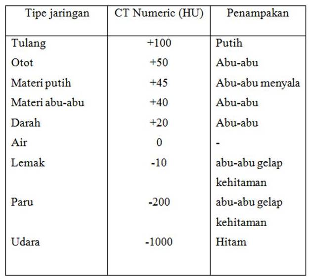 planes in ct scan