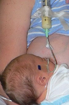 nipple shield and bottle feeding
