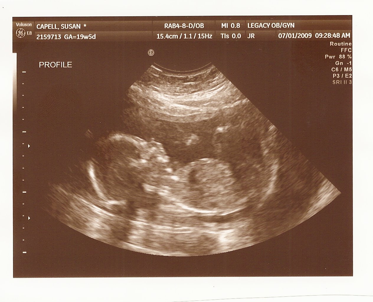 [SCAN0125.JPG]
