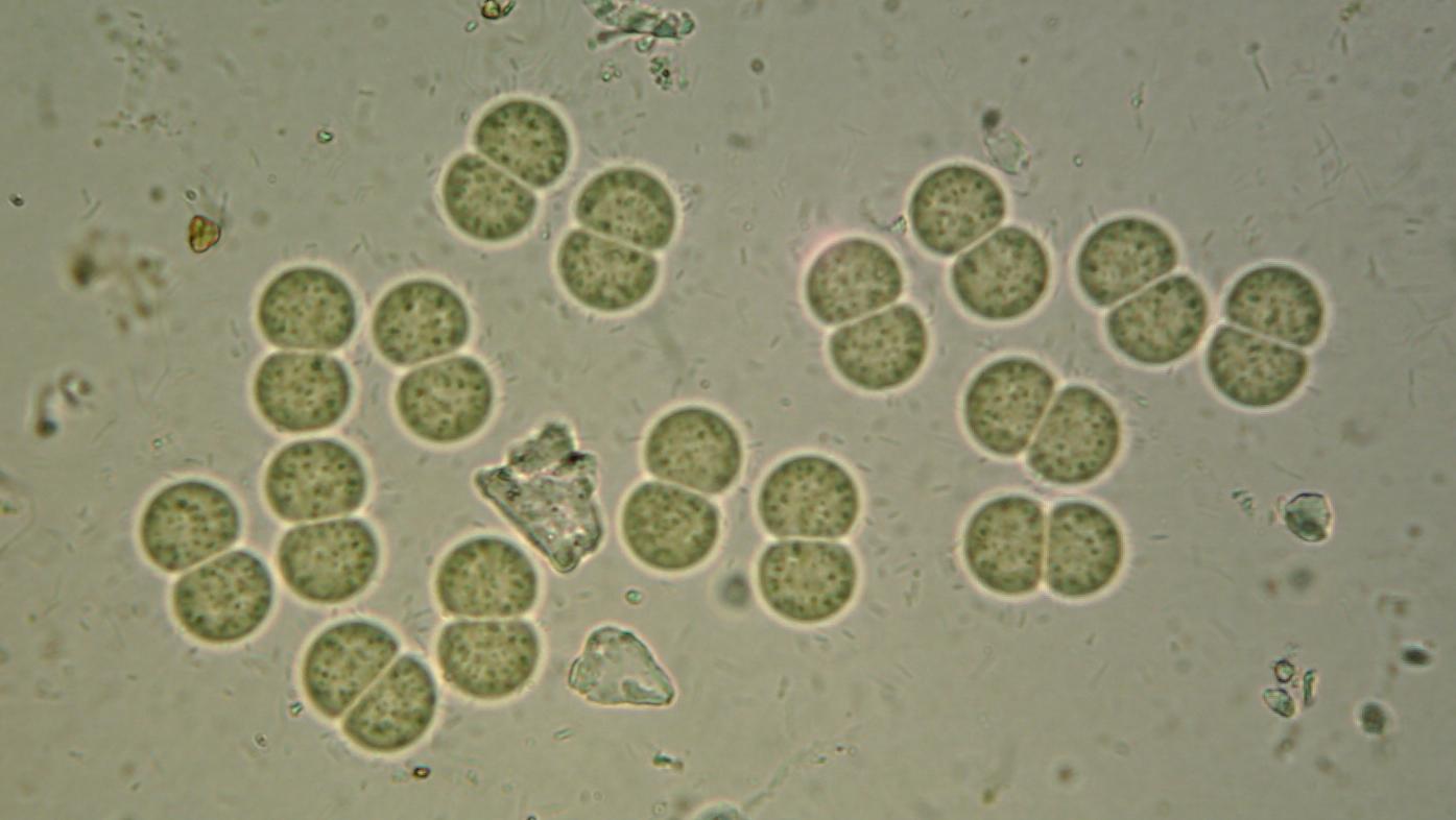 [Chrococcus2.jpg]