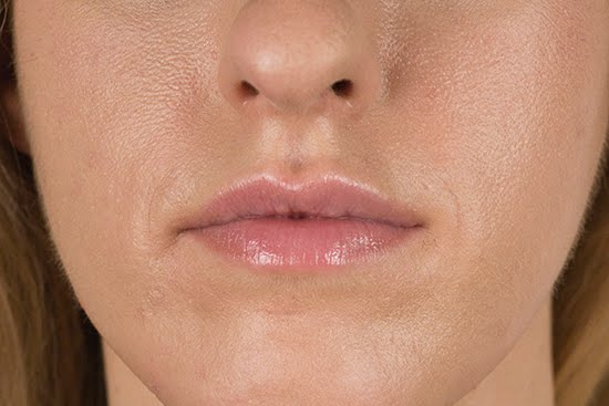 [AliceAfterCloseUpFront-1.jpg]