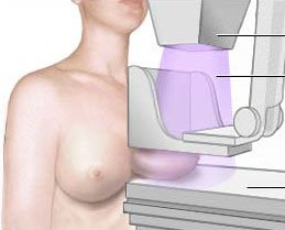[mamografia.jpg]