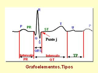 Electrocardiograma Normal