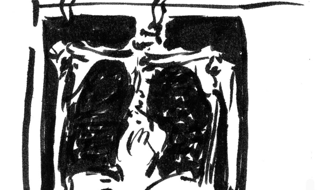 X-ray challenge | Drawing a Diagnosis