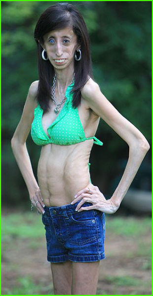 girl lizzie velasquez was