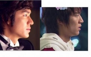   Plastic Surgery on Antoot Tips And Guides  Lee Min Ho Jun Pyo Had Plastic Surgery