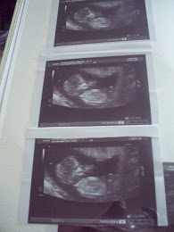 13 week scan picture x