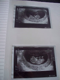 8 week scan picture x