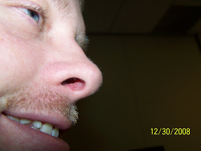 My mug shot.