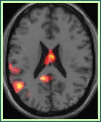[fmri-brain-colors.gif]