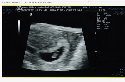 Healthy+heartbeat+at+7+weeks