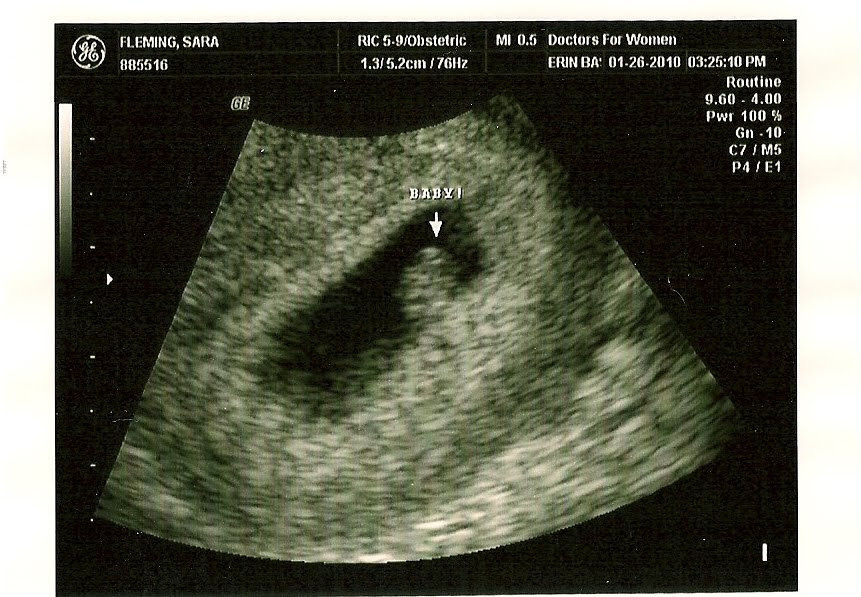 [Ultrasound10001.jpg]